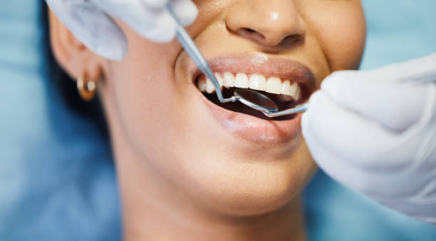 Best Emergency Dental Care for Broken or Chipped Teeth in Cheswick, PA